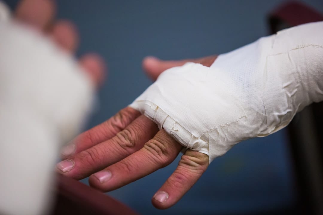 How to Find a Burn Injury Lawyer for Fair Compensation
