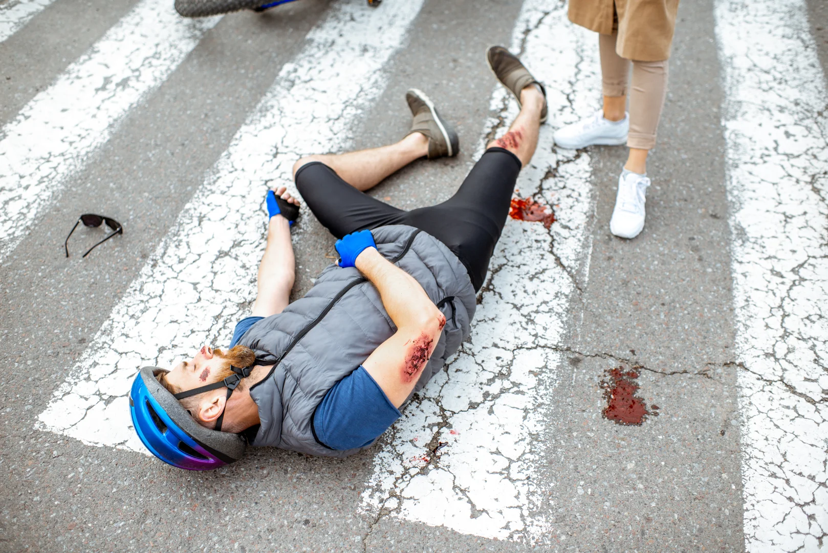 Bicycle Accident Compensation in Louisiana: What Is Your Claim Worth?