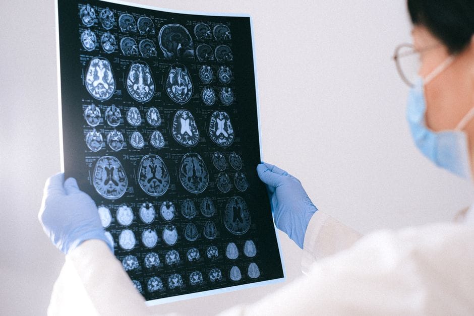Lost and Found: How a Brain Injury Resource Center Can Guide Your Healing Journey