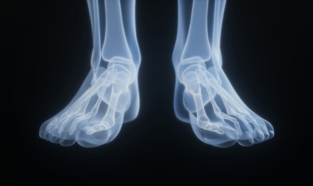 when-should-you-hire-a-broken-bone-accident-attorney-in-new-orleans-image Broken bone X-ray and legal documents