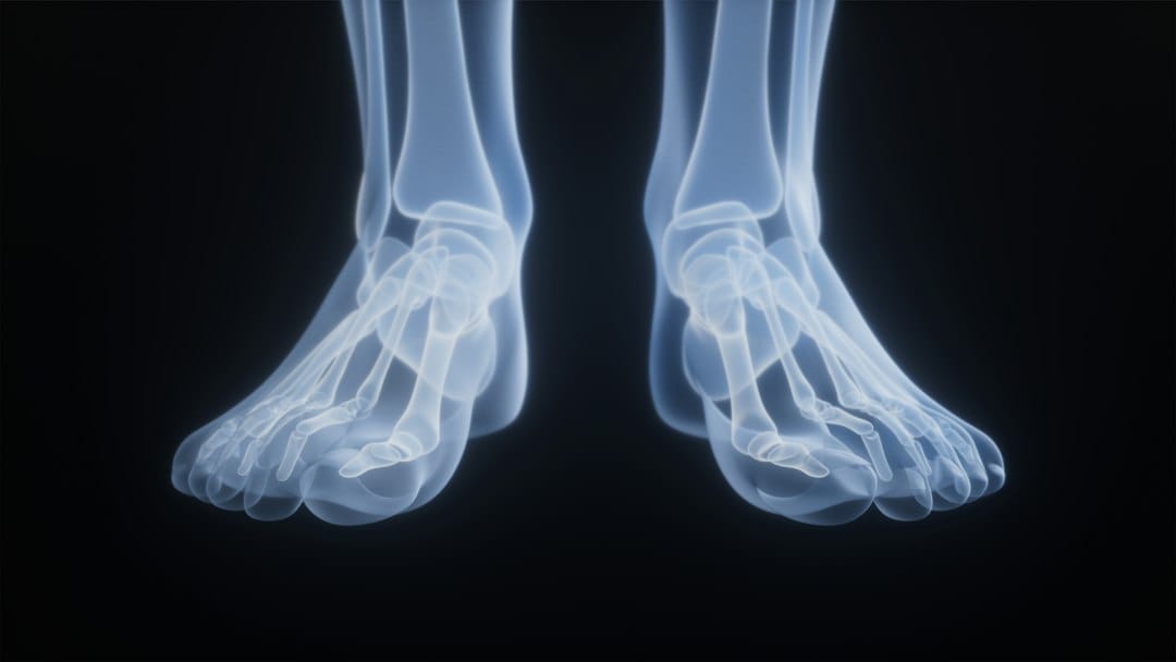 Broken bone X-ray and legal documents