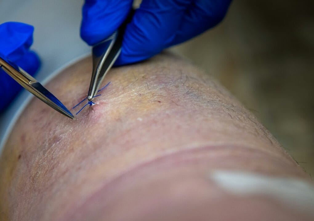 why-hiring-a-skilled-scarring-injury-attorney-in-gretna-protects-your-future-image scarring injury attorney