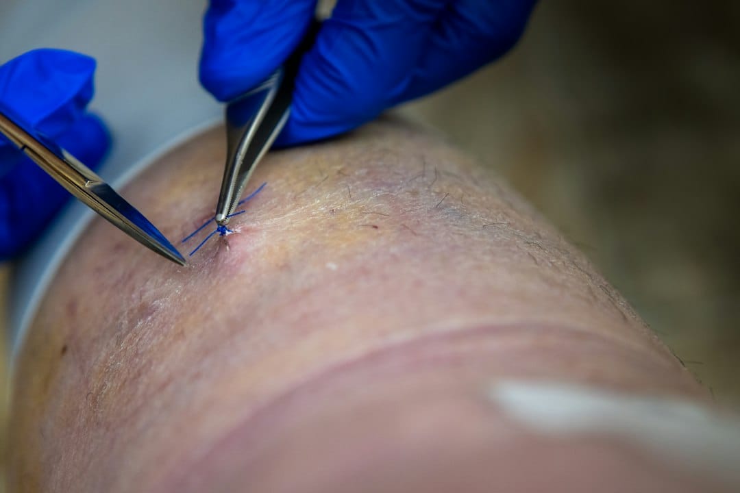 scarring injury attorney